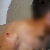 Quiso robarle a una mujer, los vecinos lo atraparon y le dieron para que tenga: así lo dejaron