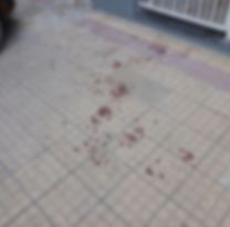 Alto Comedero: Una mujer salió de una casa gritando y con la cara llena de sangre