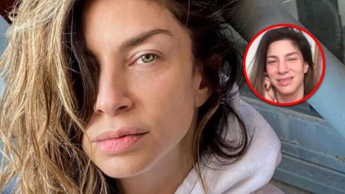 "Perd� la visi�n y la movilidad". Romina Gaetani cont� el extra�o caso que la dej� internada