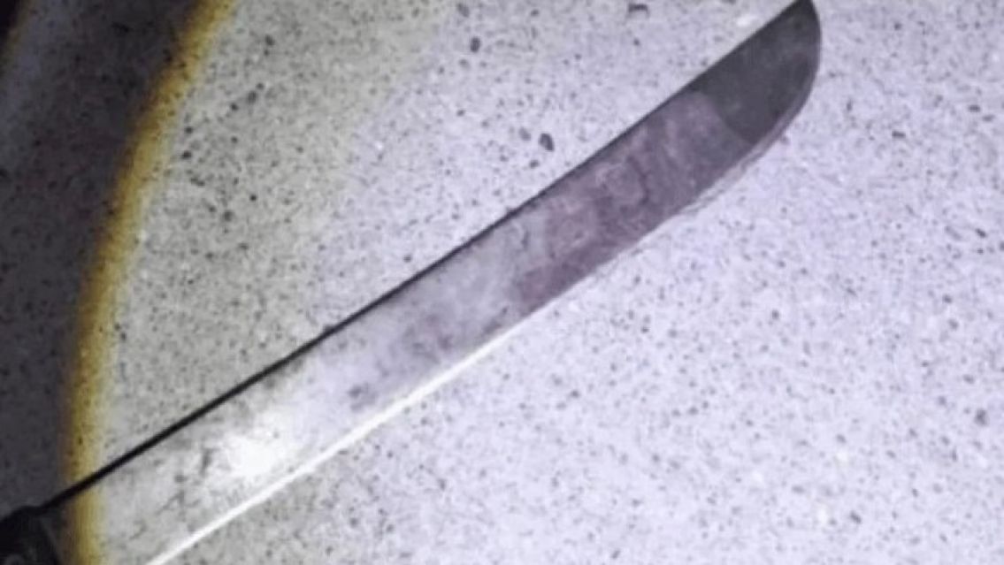 Encontró a un ladrón en el garaje de su casa y le amputó varios dedos a machetazos