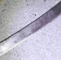 Encontr&oacute; a un ladr&oacute;n en el garaje de su casa y le amput&oacute; varios dedos a machetazos