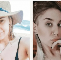 Impactante "antes y después" de La Tora de Gran Hermano, se hizo otra cirugía