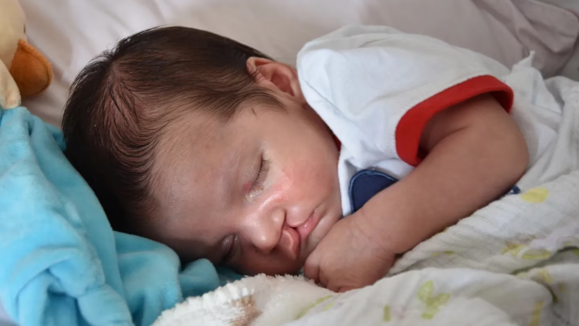 Gran hallazgo, descubren las causas de la formación del labio leporino