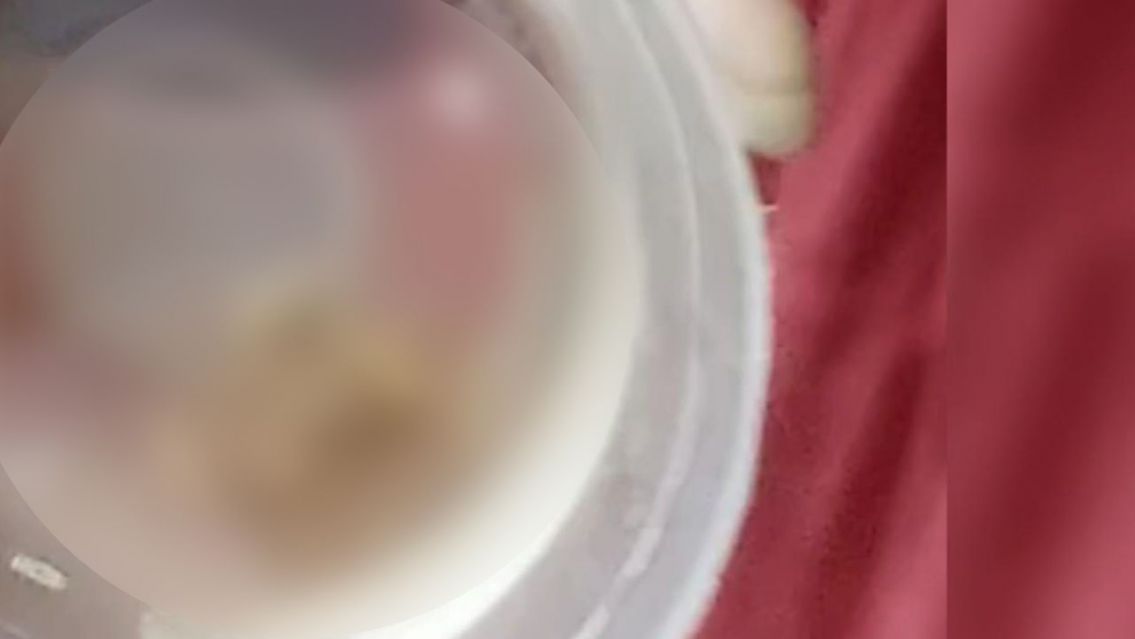 "Sufriendo y llorando del dolor": nene tiene larvas en la boca y necesita ayuda