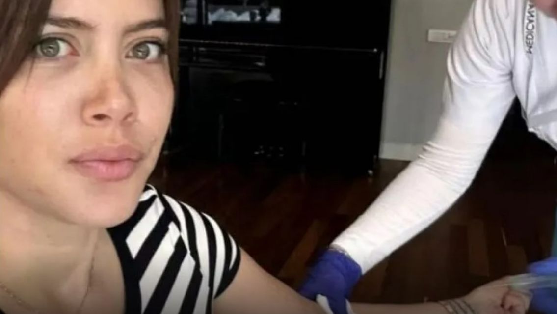 Por primera vez, Wanda Nara mostró fotos de su tratamiento y contó detalles