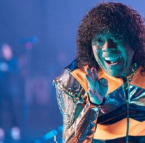 La Mona Jim&eacute;nez tuvo un ACV y est&aacute; internado. Piden oraciones para que mejore