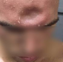 Jujeños tomaron de más y uno le partió la cabeza al otro: no lo denunció