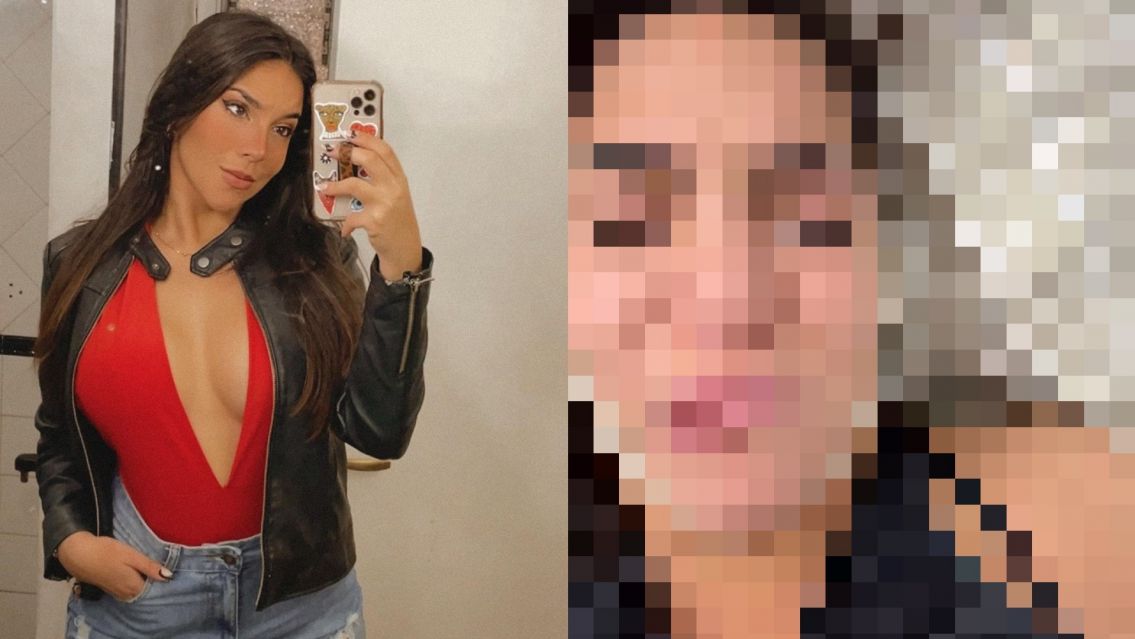 Era de las más lindas del país, se hizo una lipo y quedó con parálisis facial