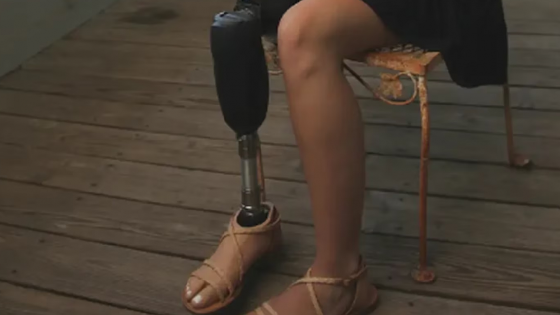 La atacó, le terminaron amputando una pierna y ella se defendió arrancándole los ojos