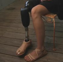 La atac&oacute;, le terminaron amputando una pierna y ella se defendi&oacute; arranc&aacute;ndole los ojos